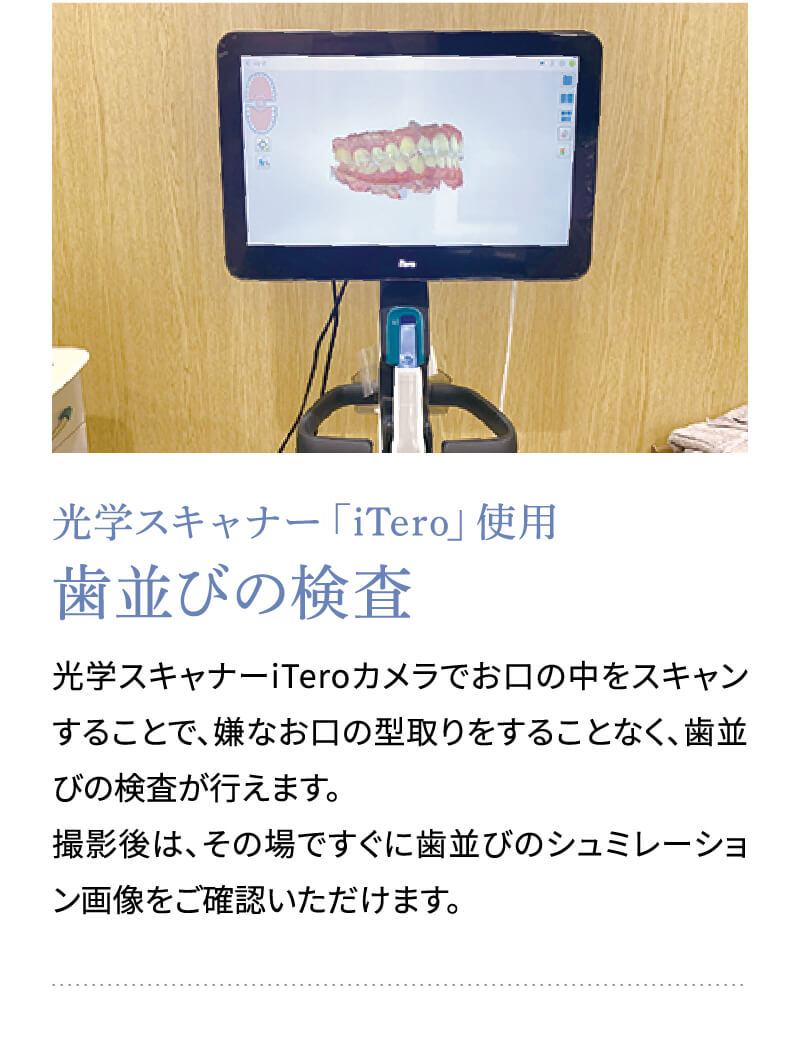 光学スキャナー「iTero」使用 歯並びの検査