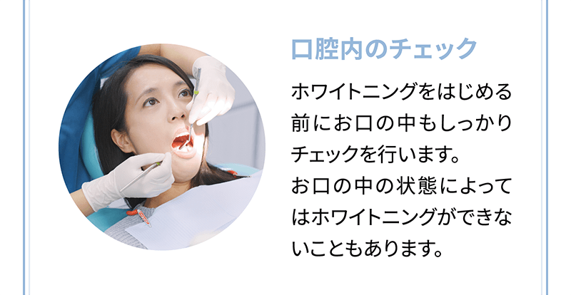 【口腔内のチェック】ホワイトニングをはじめる前にお口の中もしっかりチェックを行います。お口の中の状態によってはホワイトニングができないこともあります。