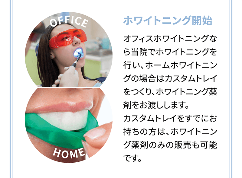 【ホワイトニング開始】オフィスホワイトニングなら当院でホワイトニングを行い、ホームホワイトニングの場合はカスタムトレイをつくり、ホワイトニング薬剤をお渡しします。カスタムトレイをすでにお持ちの方は、ホワイトニング薬剤のみの販売も可能です。