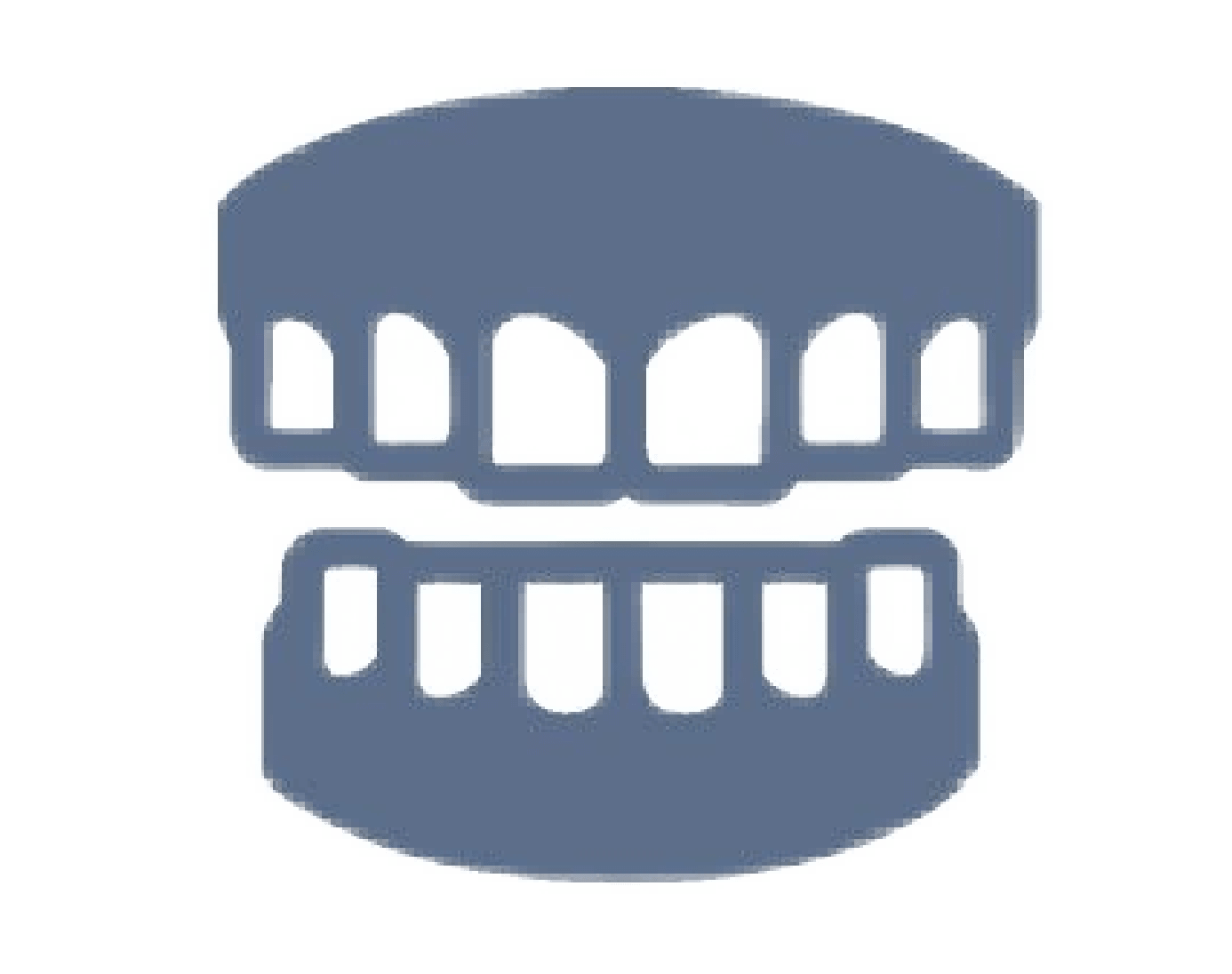 前歯だけのマウスピース矯正の適応症例