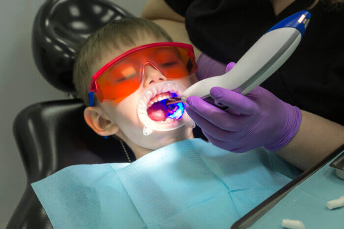 矯正治療は虫歯があってもはじめられる？むし歯との上手な付き合い方とは？